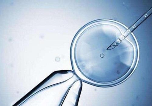 去泰國試管嬰兒可以省去沒必要的花費嗎