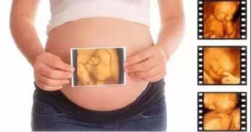 試管嬰兒三代好嗎