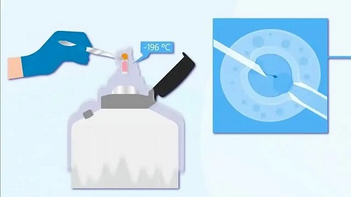 哪些人群適合做試管嬰兒