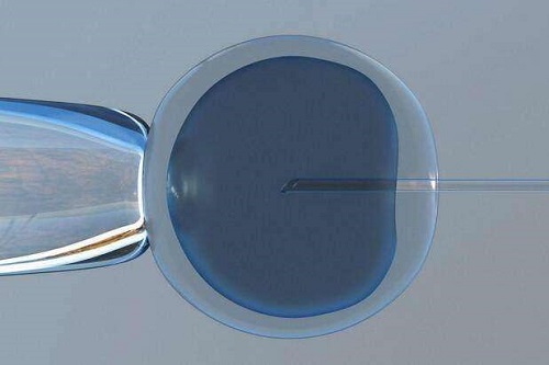 國內(nèi)做試管嬰兒的價格