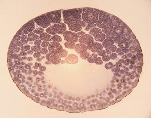 去泰國做試管需要什么手續(xù)